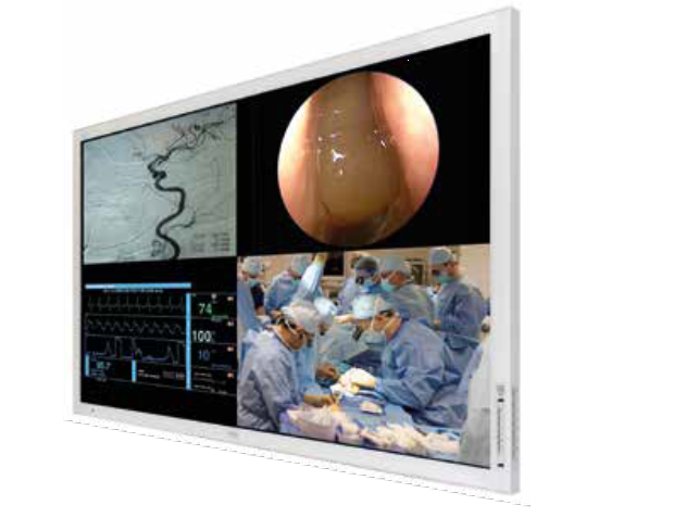 Medical Monitor - 55” Touch Medical Display