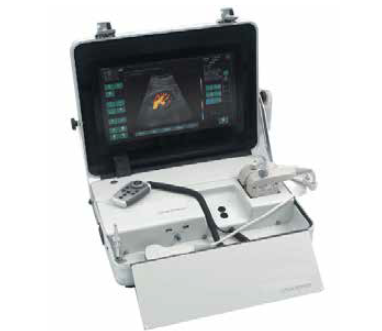 Ultrasonography Unit Mobile Color